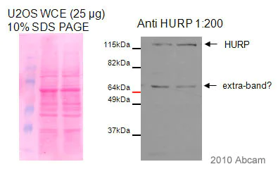 Western blot - Anti-HURP antibody (AB84509)