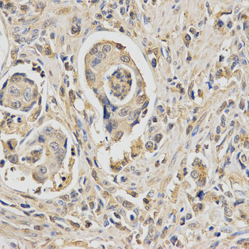 Immunocytochemistry/ Immunofluorescence - Anti-HUS1 antibody (AB186850)