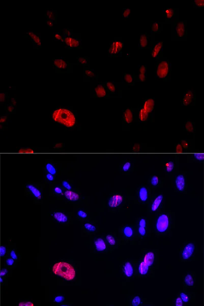 Immunocytochemistry/ Immunofluorescence - Anti-HUS1 antibody (AB186850)