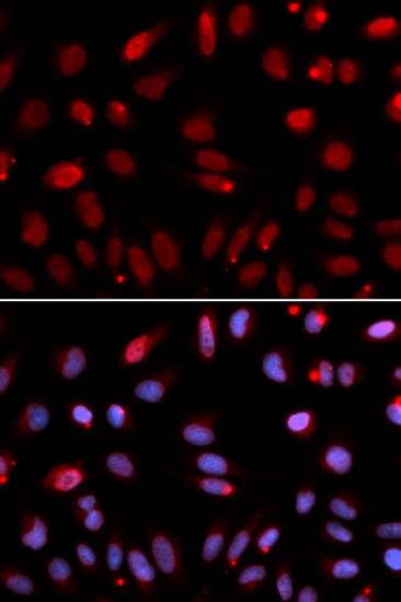 Immunocytochemistry/ Immunofluorescence - Anti-HUS1 antibody (AB186850)