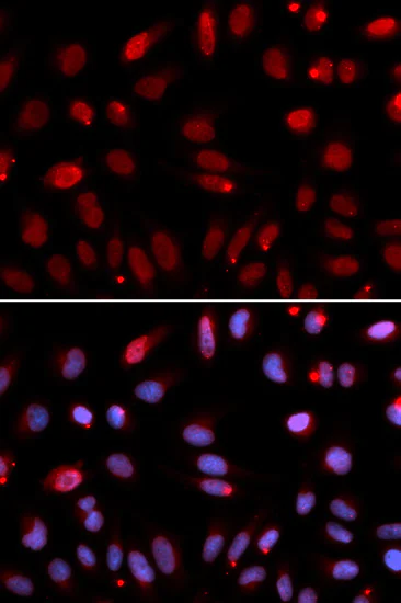 Immunocytochemistry/ Immunofluorescence - Anti-HUS1 antibody (AB186850)