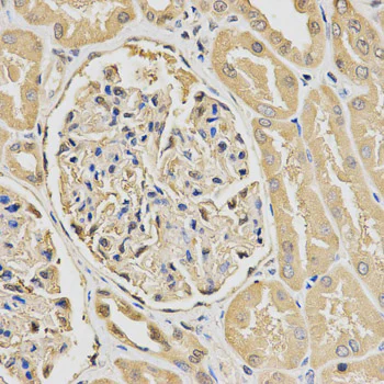 Immunocytochemistry/ Immunofluorescence - Anti-HUS1 antibody (AB186850)