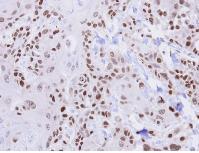 Immunohistochemistry (Formalin/PFA-fixed paraffin-embedded sections) - Anti-HUS1 antibody (AB96297)