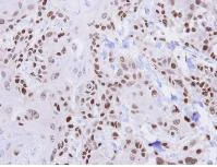Immunohistochemistry (Formalin/PFA-fixed paraffin-embedded sections) - Anti-HUS1 antibody (AB96297)