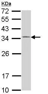 Western blot - Anti-HUS1 antibody (AB96297)