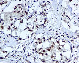 Immunohistochemistry (Formalin/PFA-fixed paraffin-embedded sections) - Anti-HUS1 antibody [EPR5132] (AB109371)