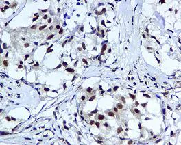 Immunohistochemistry (Formalin/PFA-fixed paraffin-embedded sections) - Anti-HUS1 antibody [EPR5132] (AB109371)