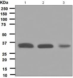 Western blot - Anti-HUS1 antibody [EPR5132] (AB109371)