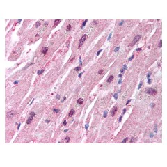 Immunohistochemistry (Formalin/PFA-fixed paraffin-embedded sections) - Anti-HUWE1/Mule antibody (AB65153)