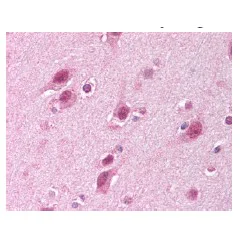 Immunohistochemistry (Formalin/PFA-fixed paraffin-embedded sections) - Anti-HUWE1/Mule antibody (AB65153)
