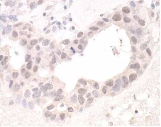 Immunohistochemistry (Formalin/PFA-fixed paraffin-embedded sections) - Anti-HUWE1/Mule antibody (AB70161)