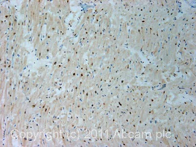 Immunohistochemistry (Formalin/PFA-fixed paraffin-embedded sections) - Anti-HUWE1/Mule antibody (AB70161)