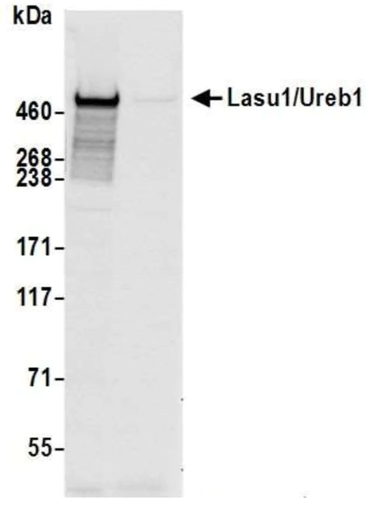 Immunoprecipitation - Anti-HUWE1/Mule antibody (AB70161)