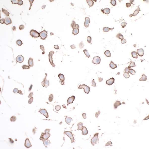 Immunocytochemistry - Anti-HVEM/TNFRSF14 antibody [BLR062G] - BSA free (AB314104), expandable thumbnail
