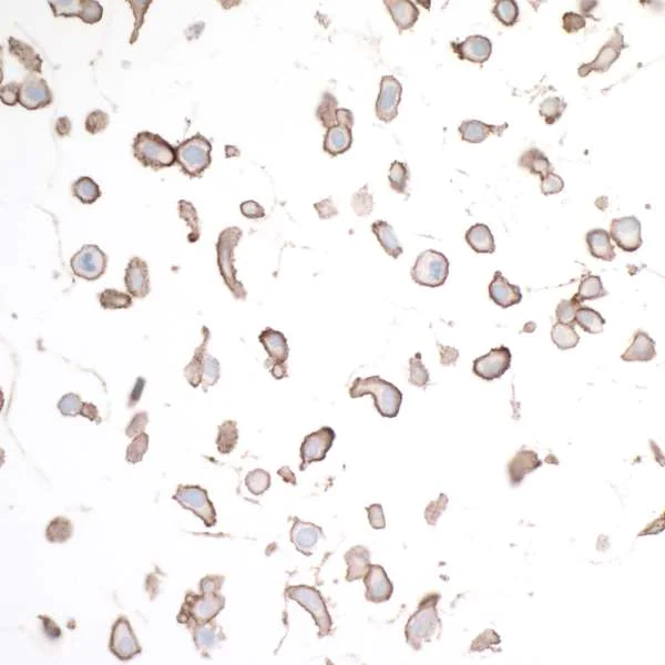 Immunocytochemistry - Anti-HVEM/TNFRSF14 antibody [BLR062G] - BSA free (AB314104)