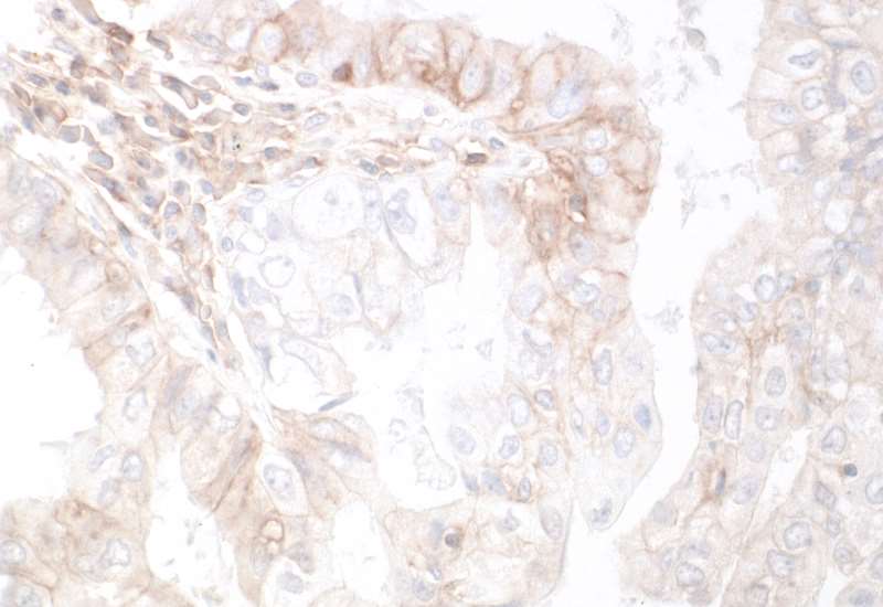 Immunohistochemistry (Formalin/PFA-fixed paraffin-embedded sections) - Anti-HVEM/TNFRSF14 antibody [BLR062G] - BSA free (AB314104), expandable thumbnail