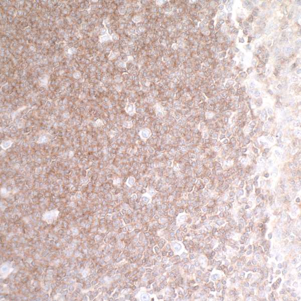 Immunohistochemistry (Formalin/PFA-fixed paraffin-embedded sections) - Anti-HVEM/TNFRSF14 antibody [BLR062G] - BSA free (AB314104), expandable thumbnail