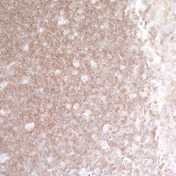 Immunohistochemistry (Formalin/PFA-fixed paraffin-embedded sections) - Anti-HVEM/TNFRSF14 antibody [BLR062G] - BSA free (AB314104)