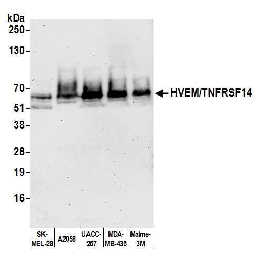 Western blot - Anti-HVEM/TNFRSF14 antibody [BLR062G] - BSA free (AB314104), expandable thumbnail