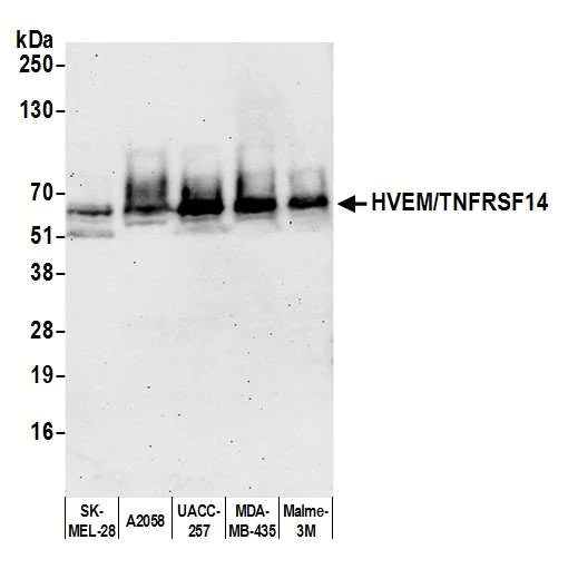 Western blot - Anti-HVEM/TNFRSF14 antibody [BLR062G] - BSA free (AB314104)