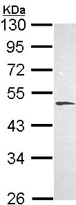 Western blot - Anti-HYAL1 antibody (AB103977)
