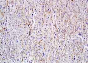 Immunohistochemistry (Formalin/PFA-fixed paraffin-embedded sections) - Anti-HYAL1 antibody (AB203293)