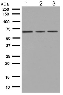 Western blot - Anti-HYAL1 antibody [EPR5542] - BSA and Azide free (AB250152)