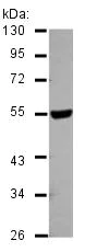 Western blot - Anti-HYAL2 antibody (AB126099)