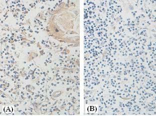 Immunohistochemistry (Formalin/PFA-fixed paraffin-embedded sections) - Anti-HYAL2 antibody (AB90004)