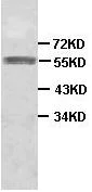 Western blot - Anti-HYAL2 antibody (AB90004)