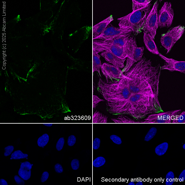Immunocytochemistry/ Immunofluorescence - Anti-HYAL2 antibody [EPR28917-156] (ab323609), expandable thumbnail