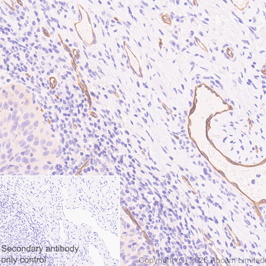 Immunohistochemistry (Formalin/PFA-fixed paraffin-embedded sections) - Anti-HYAL2 antibody [EPR28917-156] (AB323609), expandable thumbnail