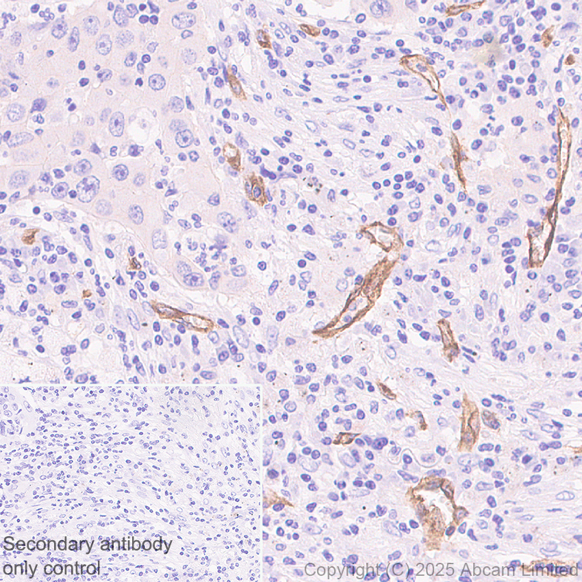 Immunohistochemistry (Formalin/PFA-fixed paraffin-embedded sections) - Anti-HYAL2 antibody [EPR28917-156] (AB323609), expandable thumbnail