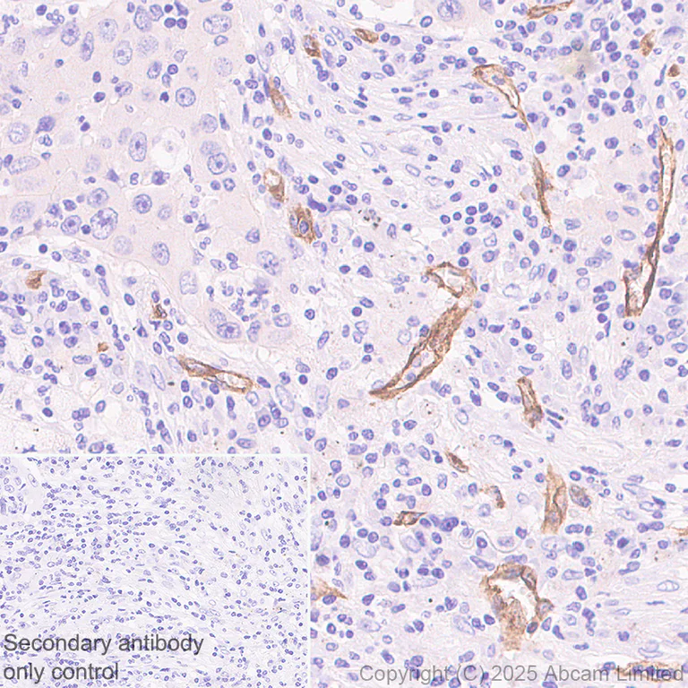 Immunohistochemistry (Formalin/PFA-fixed paraffin-embedded sections) - Anti-HYAL2 antibody [EPR28917-156] (AB323609)