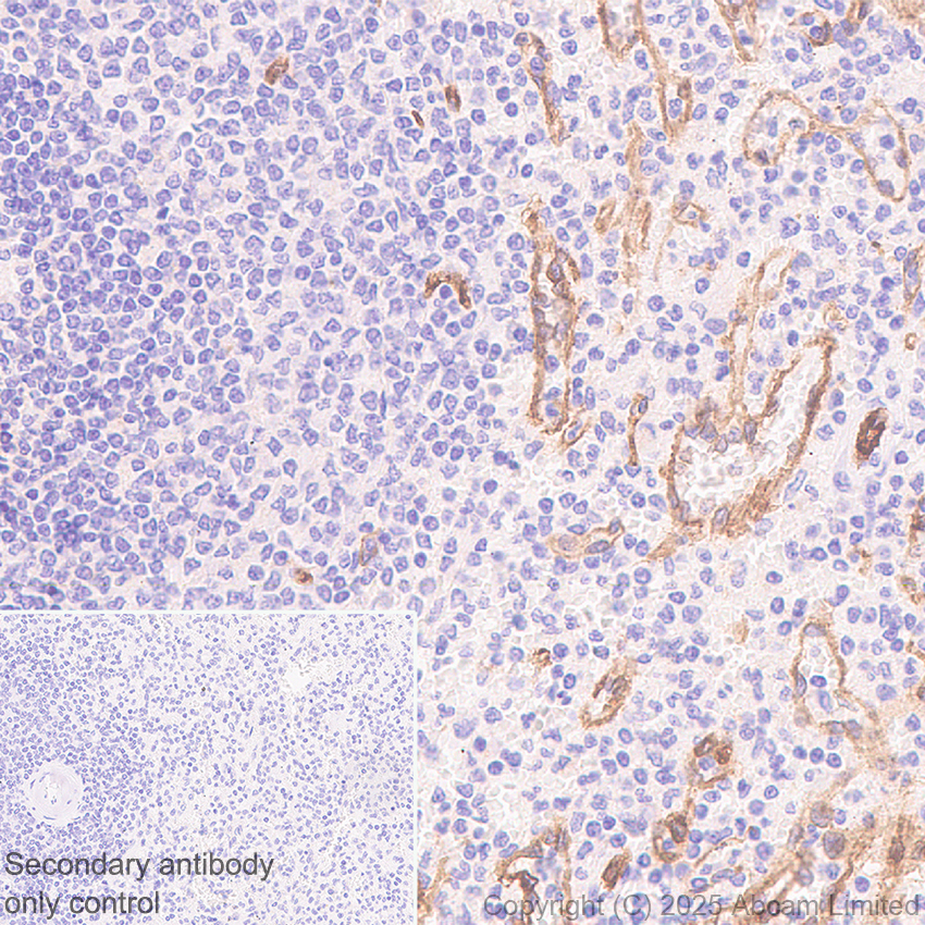 Immunohistochemistry (Formalin/PFA-fixed paraffin-embedded sections) - Anti-HYAL2 antibody [EPR28917-156] (AB323609), expandable thumbnail