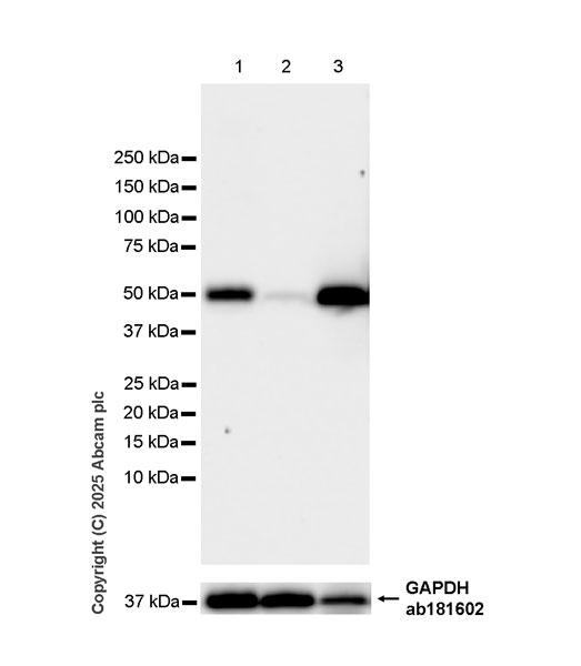 Western blot - Anti-HYAL2 antibody [EPR28917-156] (ab323609), expandable thumbnail