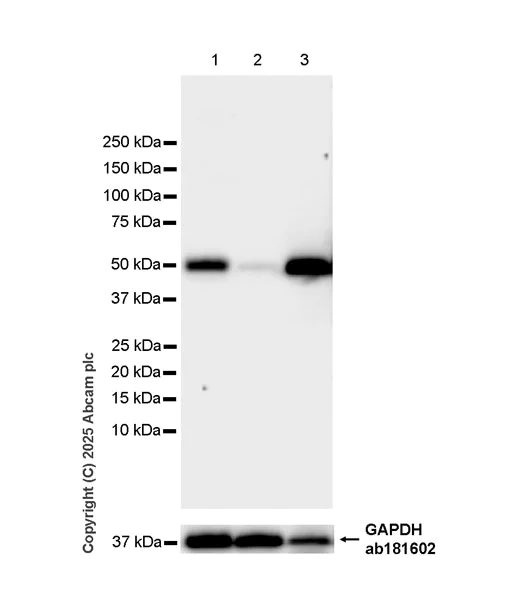 Western blot - Anti-HYAL2 antibody [EPR28917-156] (AB323609)