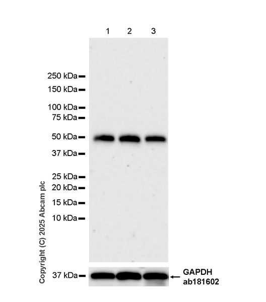 Western blot - Anti-HYAL2 antibody [EPR28917-156] (ab323609), expandable thumbnail