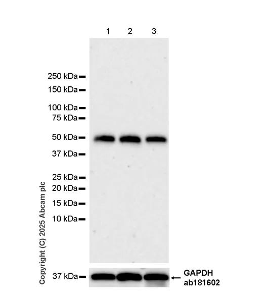 Western blot - Anti-HYAL2 antibody [EPR28917-156] (AB323609)