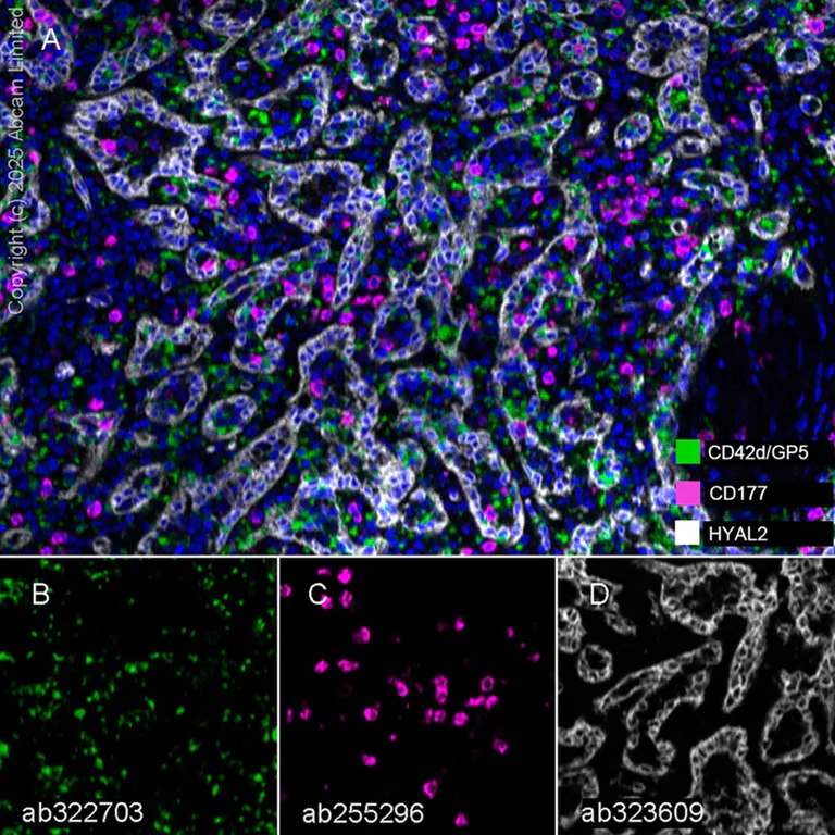Multiplex immunohistochemistry - Anti-HYAL2 antibody [EPR28917-156] - BSA and Azide free (AB323610)