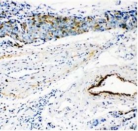 Immunohistochemistry (Formalin/PFA-fixed paraffin-embedded sections) - Anti-HYAL3 antibody (AB151767), expandable thumbnail