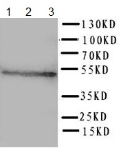 Western blot - Anti-HYAL3 antibody (AB151767), expandable thumbnail
