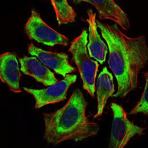 Immunocytochemistry/ Immunofluorescence - Anti-Hyaluronan synthase 2 antibody [4E7] (AB140671), expandable thumbnail