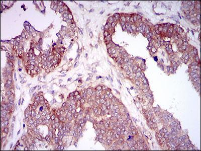 Immunohistochemistry (Formalin/PFA-fixed paraffin-embedded sections) - Anti-Hyaluronan synthase 2 antibody [4E7] (AB140671), expandable thumbnail