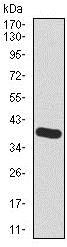 Western blot - Anti-Hyaluronan synthase 2 antibody [4E7] (AB140671), expandable thumbnail