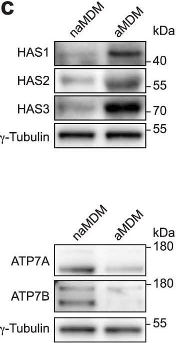 Western blot - Anti-Hyaluronan synthase 2 antibody [4E7] (ab140671), expandable thumbnail