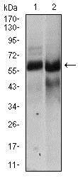 Western blot - Anti-Hyaluronan synthase 2 antibody [4E7] (AB140671), expandable thumbnail