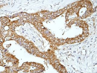 Immunohistochemistry (Formalin/PFA-fixed paraffin-embedded sections) - Anti-Hydrogen Potassium ATPase Beta/ATP4B antibody (AB176992)