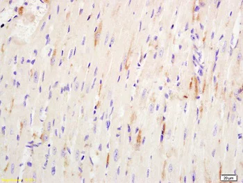 Immunohistochemistry (Formalin/PFA-fixed paraffin-embedded sections) - Anti-Hydrogen Potassium ATPase Beta/ATP4B antibody (AB217336)