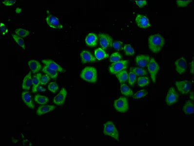 Immunocytochemistry/ Immunofluorescence - Anti-HYPE antibody (AB237521)